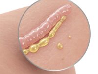 sebum-nedir